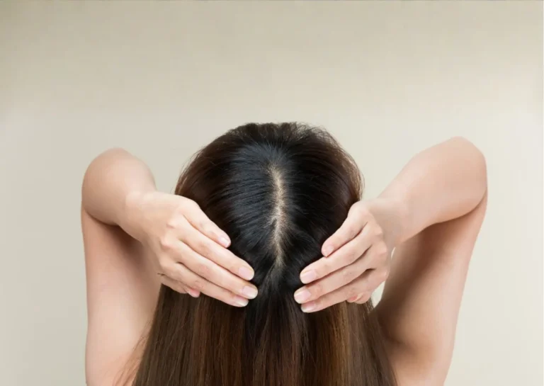 Understanding Postpartum Hair Changes: Exploring Supportive Approaches